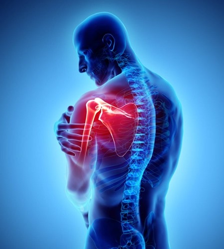 frozen-shoulder-pain-img