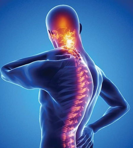 spondylitis img